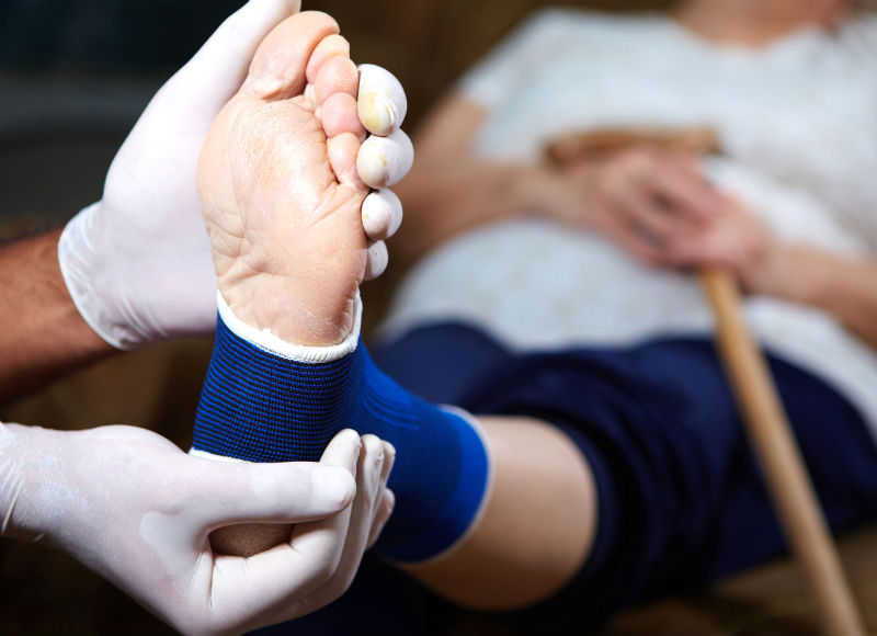 What Ankle Surgeons In Racine, WI, Have To Say About Adult Flatfoot