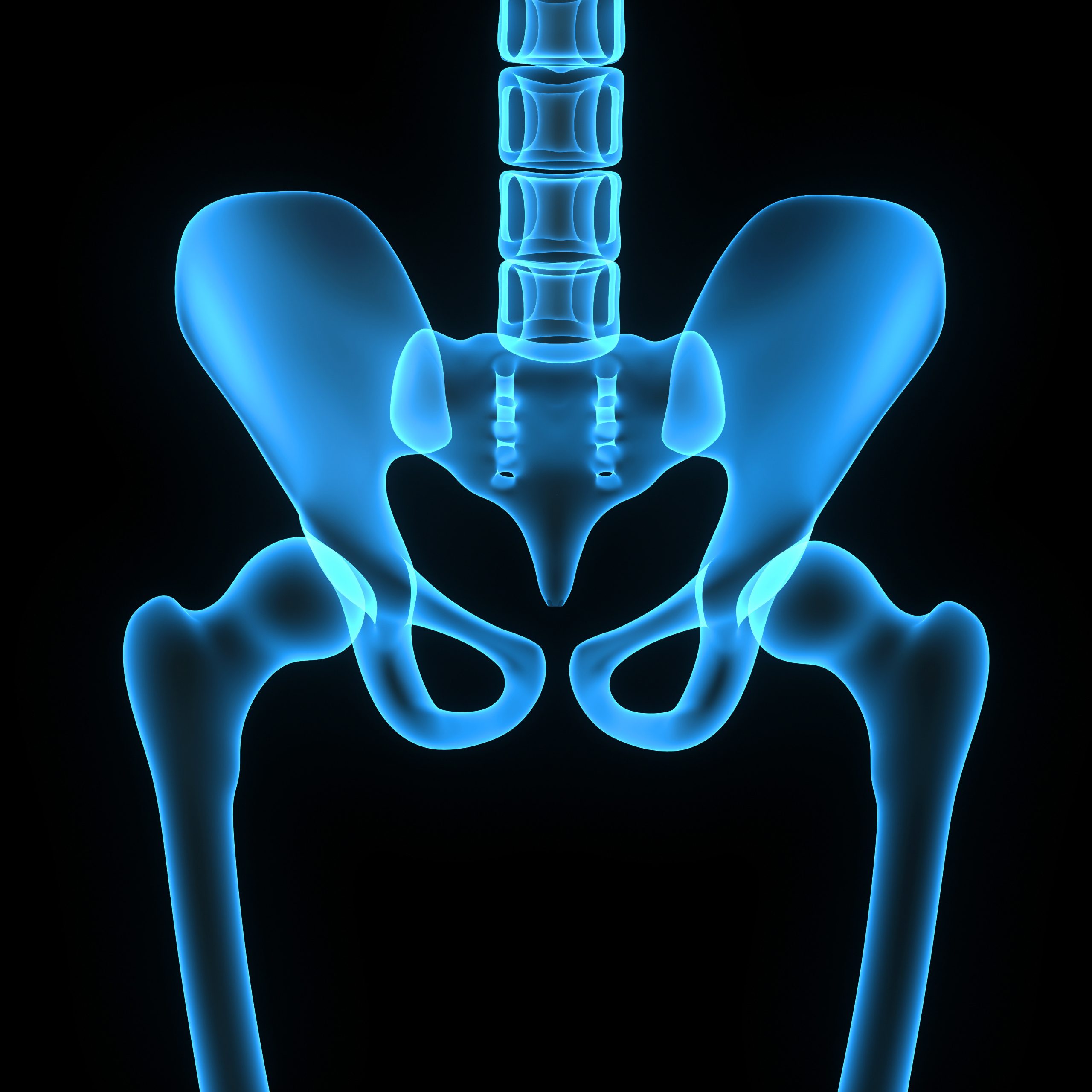 Can You Choose the Implant Used for Your Colorado Springs Hip Replacement?