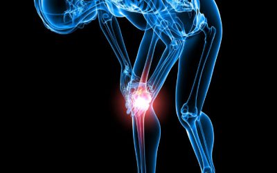 Reclaim Your Active Lifestyle with Expert Knee Replacement in Warwick, RI